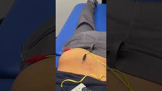 Dry Needling for One-Sided Back Pain — Watch This Fix 🔥