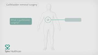 Keyhole surgery for gallbladder removal | Spire Healthcare