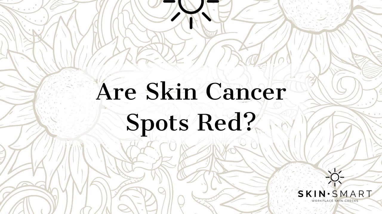 Are Skin Cancer Spots Red Youtube