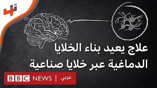 علاج لإعادة بناء الخلايا الدماغية باستخدام خلايا صناعية