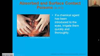 Chapter 21 video lecture