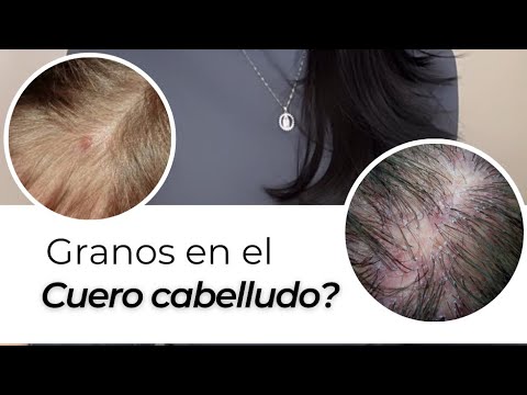 Por qué tengo