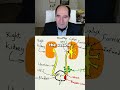 What causes kidney stones?
