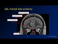 Neuroradiology review - brain gyral anatomy