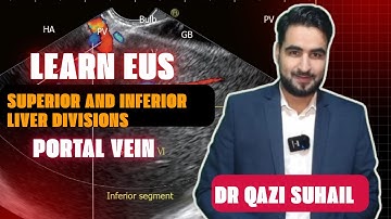 Portal Vein as a Landmark: Dividing Superior & Inferior Liver Segments | EUS Tutorial