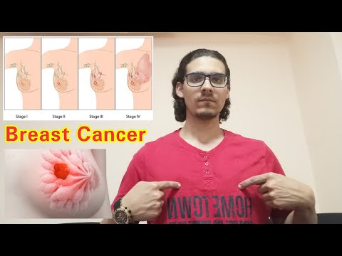 سرطان الثدي وأعراضه وأنواعه وطرق علاجه - Breast cancer, its symptoms, types and treatment