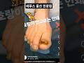#내성발톱 #IngrownToenail #ToenailCare #FootCare #NailCare #FootHealth #巻き爪 #陥入爪 #MongQuap #ChamSocChan