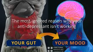 Depression - Gut inflammation, brain histamine, serotonin deficiency, and failed SSRI therapy