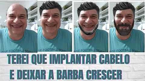 O que é o costume praeter legem?