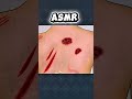 ASMR Treatment #asmr #relaxingvideos #ukdoctor #viralditiktok #SatisfyingVideo