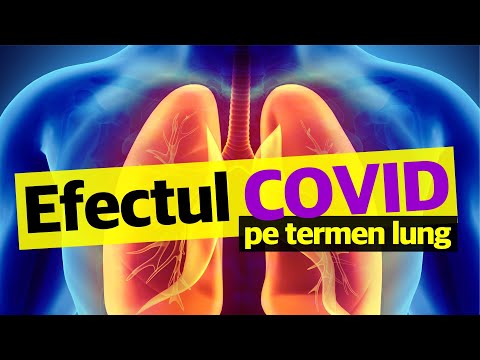 Covid și PLĂMÂNII: Efectele pe termen lung la plamani