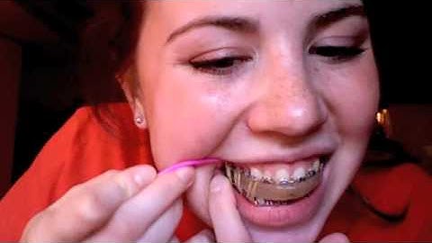 TMJ Surgical Splint Demo (Part 2)