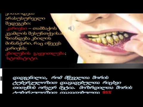 თამბაქო მავნებელია!