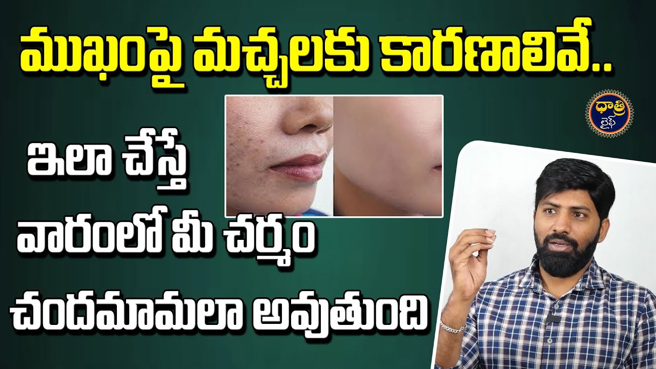 Fitness Trainer Lakshmi Narayana about Pigmentation | ముఖంపై మచ్చలకు కారణాలివే || @DhatriLife