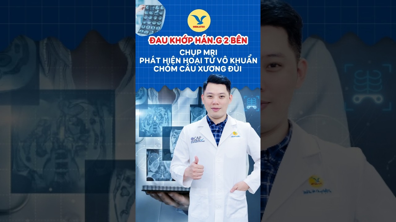 Đau khớp háng 2 bên, chụp MRI phát hiện hoại tử vô khuẩn chỏm cầu xương đùi