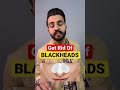 Remove BLACKHEADS at home #shorts #blackheads