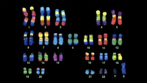 Extraordinary Variations of the Mind: Geschwind:Our Brains Berman: Williams SyndromeFisher:Language
