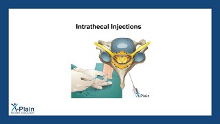 Intrathecal Injections