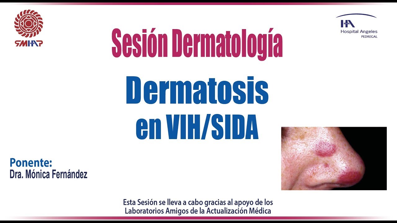 Dermatosis en VIH/SIDA - YouTube