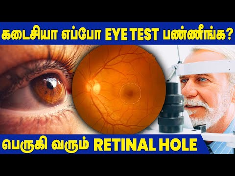 Retinal Holes - Causes, Symptoms and Preventive Measures