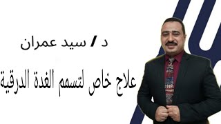 علاج خاص لتسمم الغدة الدرقية ( الحوامل - الاطفال - كبار السن - مرضى القلب - جحوظ العين )