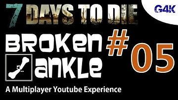 Magic Forges | 7 Days To Die Alpha 11 Multiplayer with Broken Ankle | S02E05