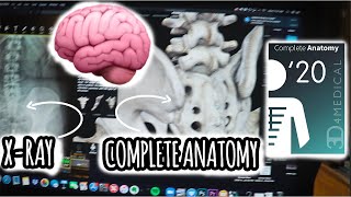 How I Use Complete Anatomy to Visualize X-Rays in a 3D View | Chiropractic School Vlog screenshot 1