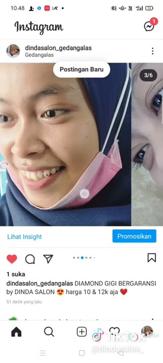 diamond gigi BERGARANSI by ig :dindasalon_gedangalas
