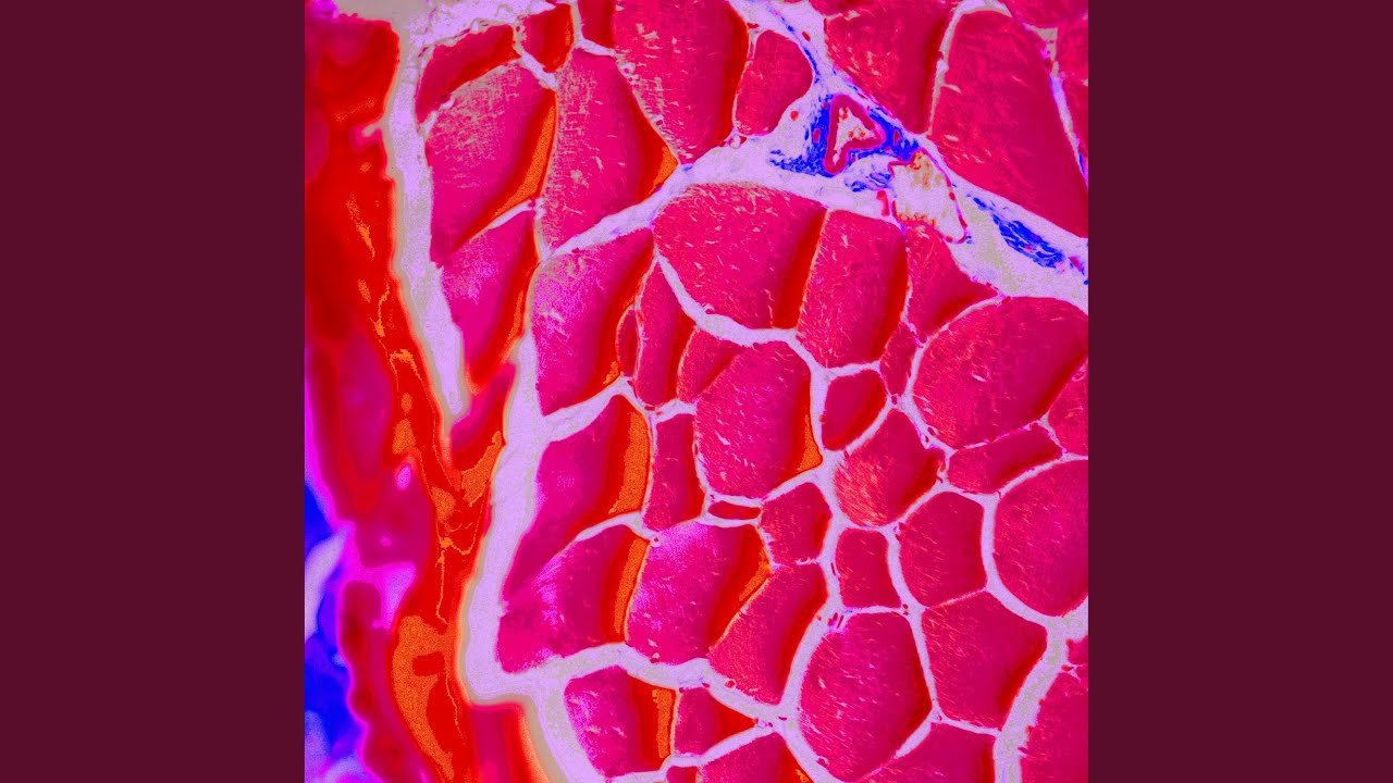 Watch achoo on YouTube Watch achoo on YouTube