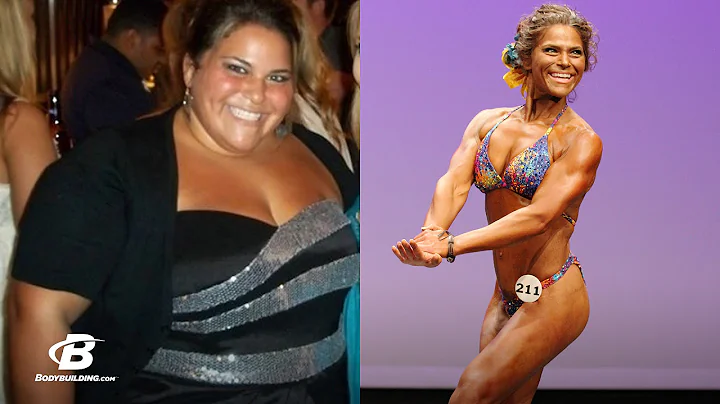 A Journey From Bariatric Surgery to Bodybuilding |...