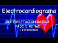 Electrocardiograma Básico: Ritmo