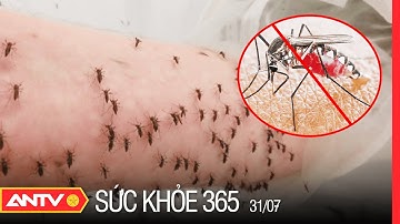 Nguyên Nhân Và Cách Điều Trị Căn Bệnh Sốt Xuất Huyết | Sức khỏe 365 | ANTV
