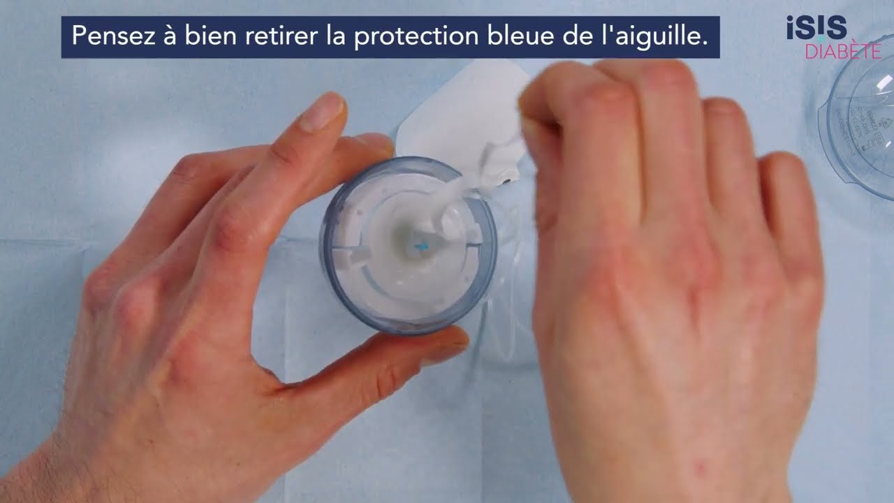 Pompe à insuline: démonstration d'un changement de cathéter de la pompe TANDEM T:slim X2