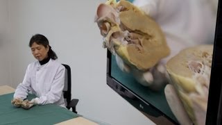 Medical Lectures In Stereoscopic 3D Intro Anatomy Of The Heart By Prof. Dr. S. Yen Ho
