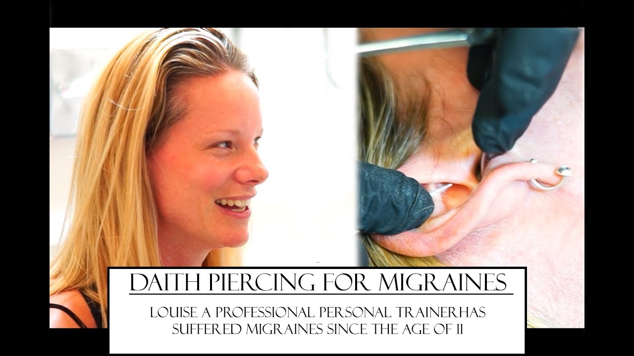 Daith Piercing for Migraines - Before & After #2 - YouTube