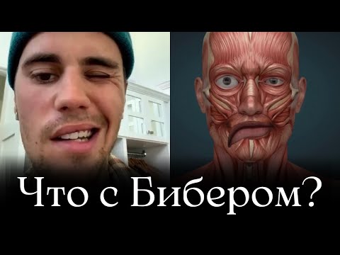 Что случилось с