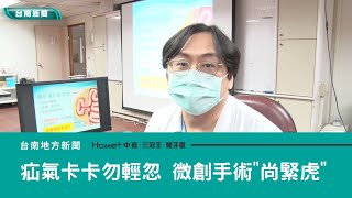 醫療|疝氣卡卡勿輕忽 微創手術“尚緊虎”