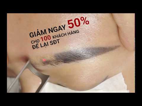 Video Xóa xăm lông mày Laser S-Light công nghệ mới - youtube