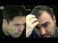 Big Blunder by Mamedyarov, He Misses the Knight Move and Hikaru Nakamura Wins the Game