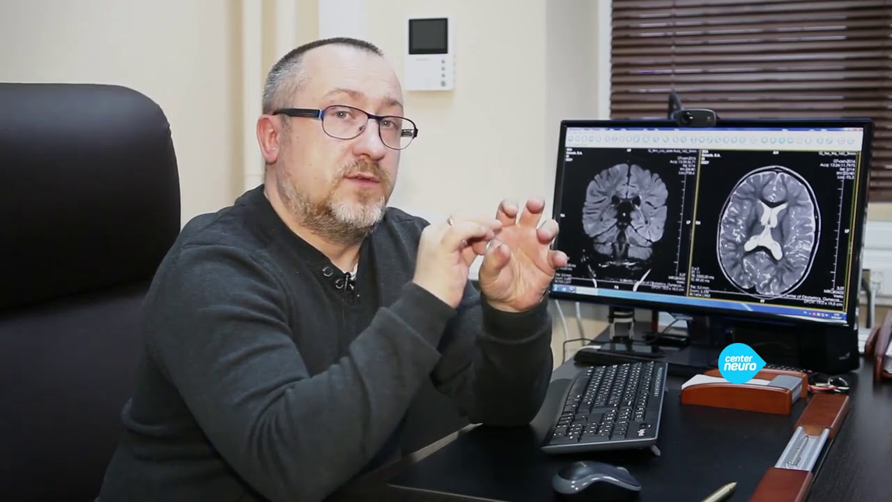 Невролог эпилептолог москва