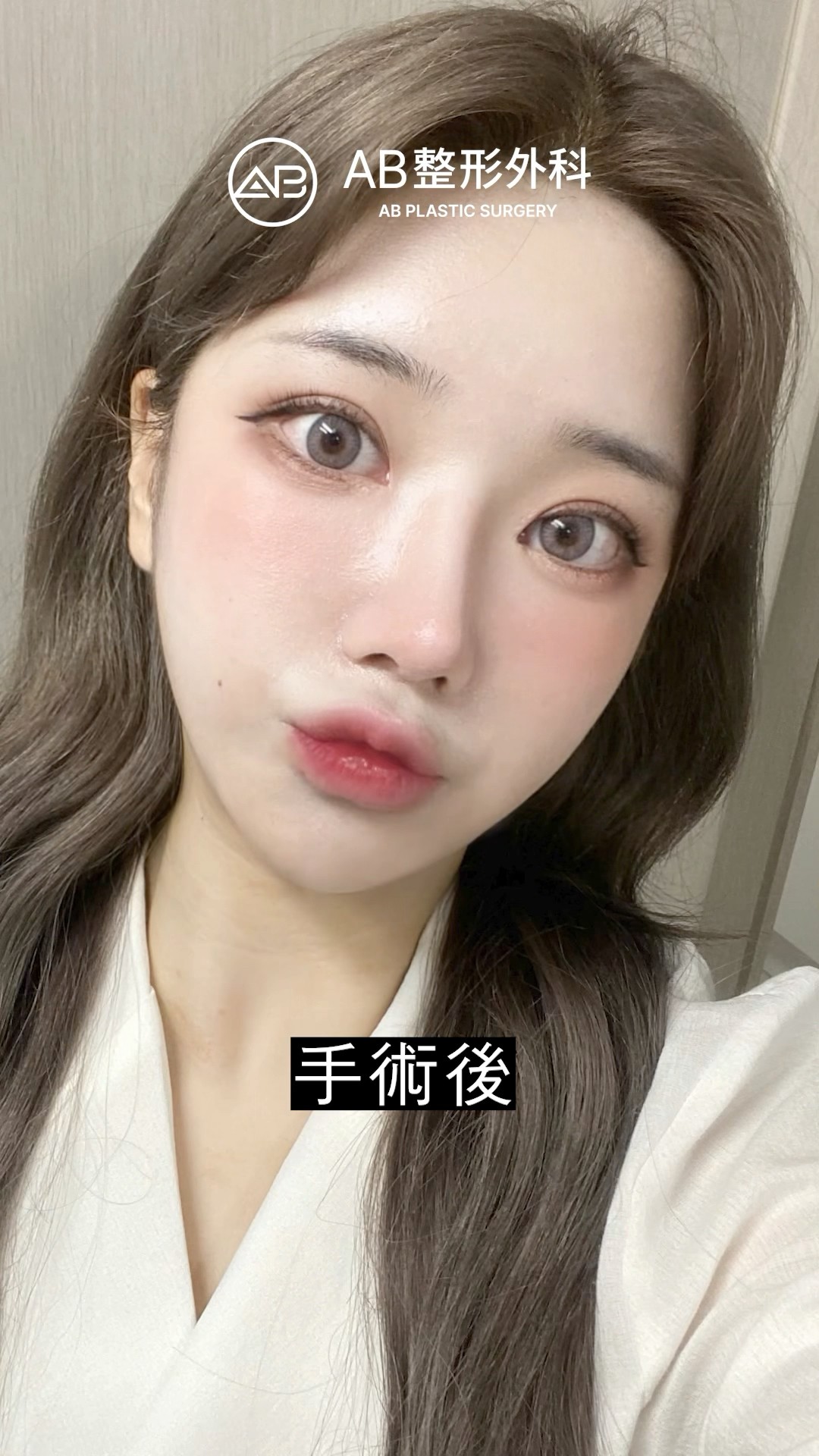 變美只靠一次手術 #shorts