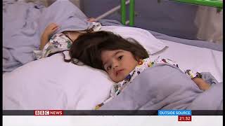 Conjoined Twins Surgical Separation Of Safa And Marwa Ukstan - Bbc News - 15Th July 2019