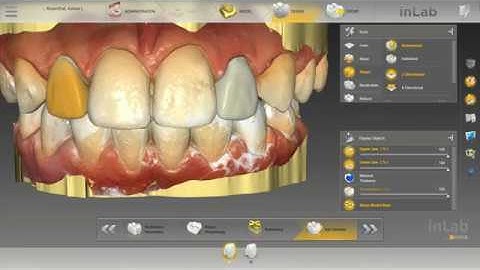 Basic #7 & #10 design with InLab SW18