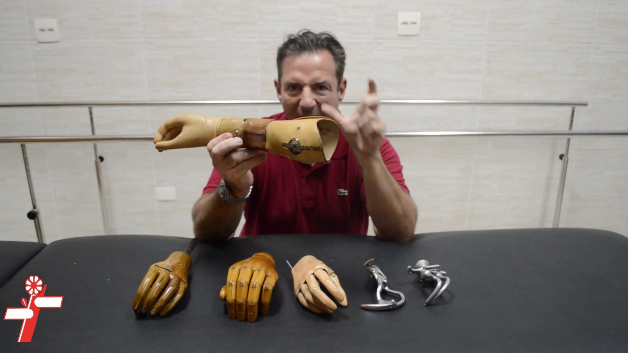 UM POUCO DA HISTORIA DAS PRÓTESES DE MÃOS - ORTOPEDIA AMERICANA