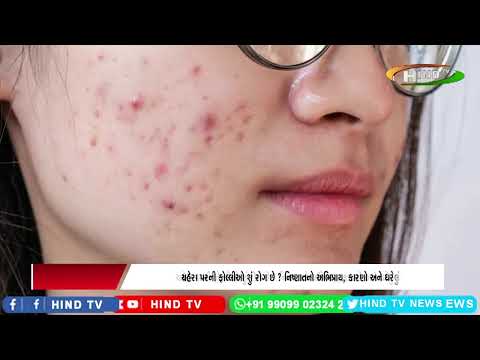 ચહેરા પરની ફોલ્લીઓ શું રોગ છે ? નિષ્ણાતનો અભિપ્રાય, કારણો અને ઘરેલું ઉપાયો જાણો!