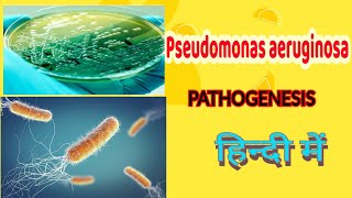 Pseudomonas aeruginosa pathogenesis, lab diagnosis & treatment || microbiology (in hindi)