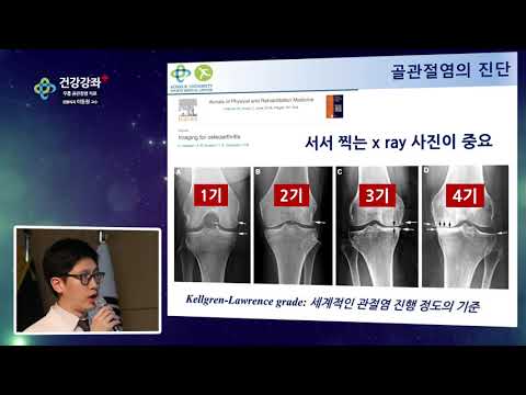 무릎 골관절염의 수술적 치료