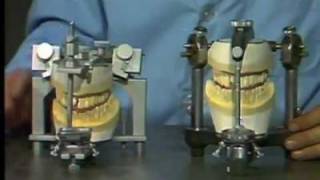 Comparing Arcon and Condylar Articulators
