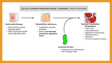 Infective Endocarditis