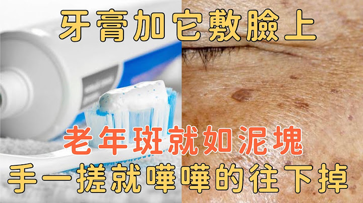 牙膏加它是老年斑的「死敵」睡前悄悄塗一層，老年斑就如泥塊，一搓就嘩嘩往下掉！讓你一夜之間重返20歲，氣色比年輕人還好！ - 天天要聞